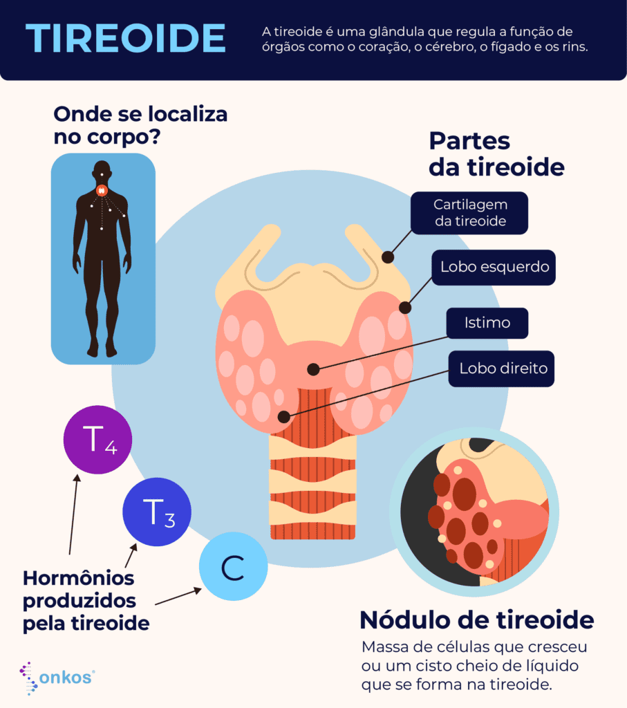 Infográfico tireoide, da para viver sem tireoide? 